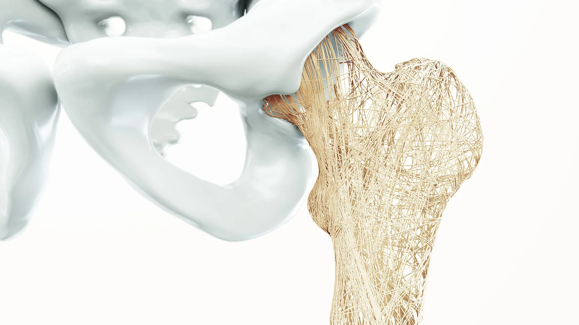 Experten Netzwerk Osteoporose Bild artifizielle Knochenstruktur Oberschenkelknochen