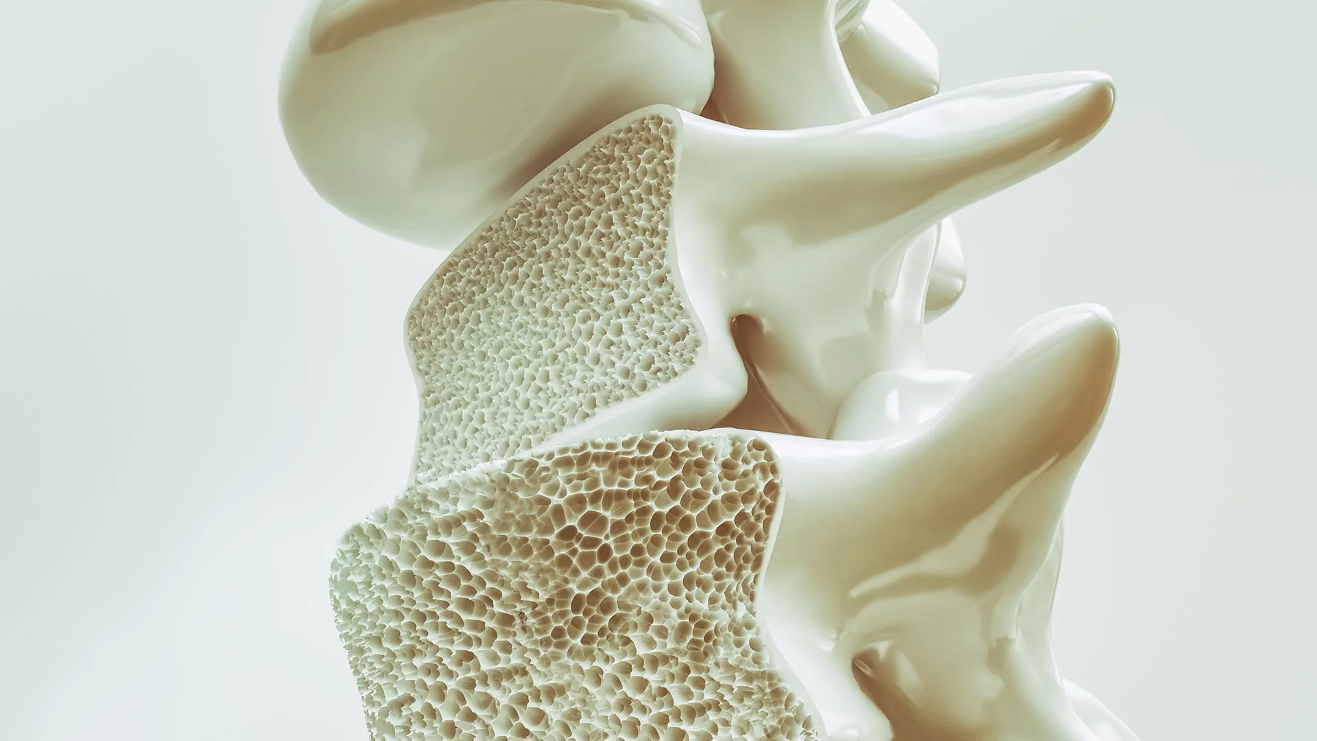 Experten Netzwerk Osteoporose Bild Knochenstruktur Wirbelsäule